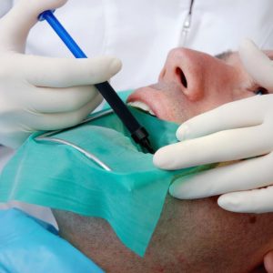 Root canal treatment in Cartagena Colombia